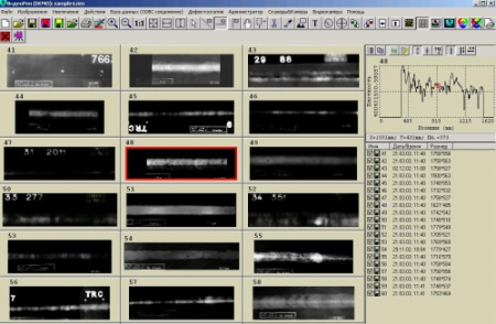 Комплекс цифровой радиографии «Градиент»
