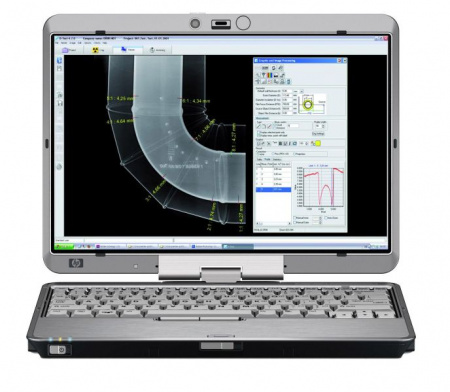 Комплекс цифровой радиографии «Градиент»