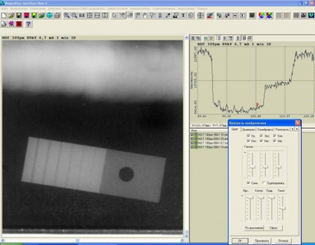 Комплекс цифровой радиографии «Градиент»